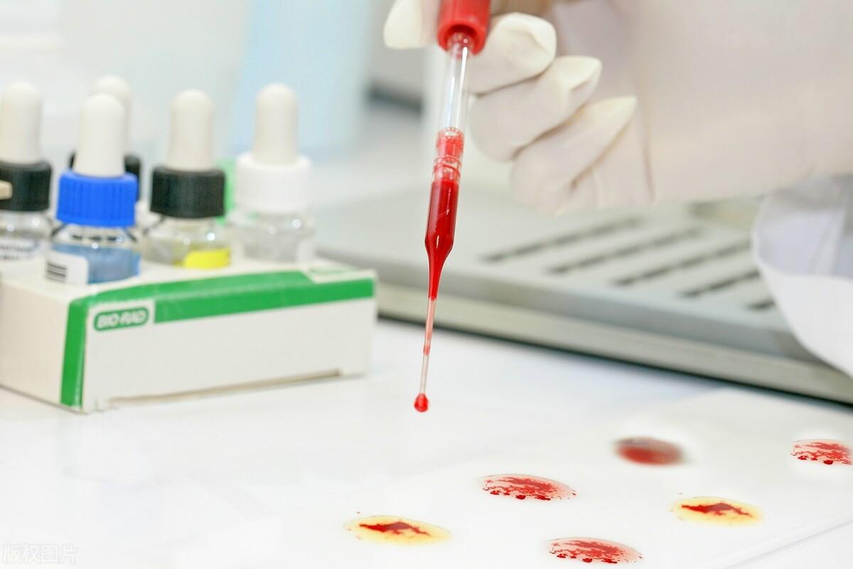 全球最稀有的血型是什么血型（世界上最稀有的血型排名）